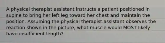 A physical therapist assistant instructs a patient positioned in supine to bring her left leg toward her chest and maintain the position. Assuming the physical therapist assistant observes the reaction shown in the picture, what muscle would MOST likely have insufficient length?