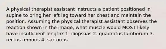 A physical therapist assistant instructs a patient positioned in supine to bring her left leg toward her chest and maintain the position. Assuming the physical therapist assistant observes the reaction shown in the image, what muscle would MOST likely have insufficient length? 1. iliopsoas 2. quadratus lumborum 3. rectus femoris 4. sartorius