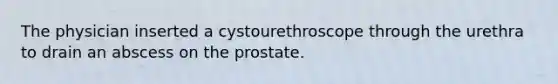 The physician inserted a cystourethroscope through the urethra to drain an abscess on the prostate.