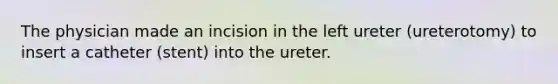 The physician made an incision in the left ureter (ureterotomy) to insert a catheter (stent) into the ureter.