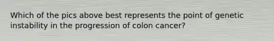 Which of the pics above best represents the point of genetic instability in the progression of colon cancer?