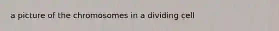 a picture of the chromosomes in a dividing cell