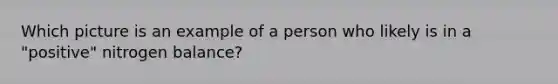 Which picture is an example of a person who likely is in a "positive" nitrogen balance?