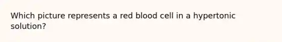 Which picture represents a red blood cell in a hypertonic solution?