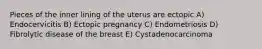 Pieces of the inner lining of the uterus are ectopic A) Endocervicitis B) Ectopic pregnancy C) Endometriosis D) Fibrolytic disease of the breast E) Cystadenocarcinoma