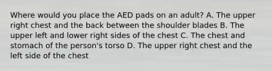 Where would you place the AED pads on an adult? A. The upper right chest and the back between the shoulder blades B. The upper left and lower right sides of the chest C. The chest and stomach of the person's torso D. The upper right chest and the left side of the chest