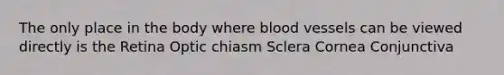 The only place in the body where blood vessels can be viewed directly is the Retina Optic chiasm Sclera Cornea Conjunctiva