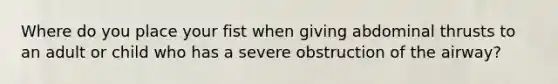 Where do you place your fist when giving abdominal thrusts to an adult or child who has a severe obstruction of the airway?