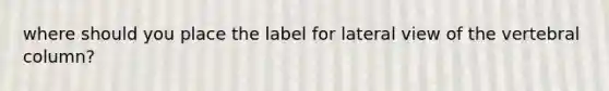 where should you place the label for lateral view of the vertebral column?