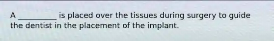 A __________ is placed over the tissues during surgery to guide the dentist in the placement of the implant.