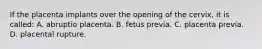 If the placenta implants over the opening of the​ cervix, it is​ called: A. abruptio placenta. B. fetus previa. C. placenta previa. D. placental rupture.