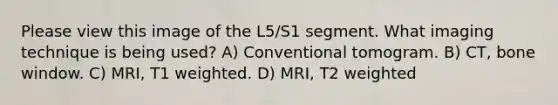 Please view this image of the L5/S1 segment. What imaging technique is being used? A) Conventional tomogram. B) CT, bone window. C) MRI, T1 weighted. D) MRI, T2 weighted