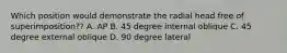 Which position would demonstrate the radial head free of superimposition?? A. AP B. 45 degree internal oblique C. 45 degree external oblique D. 90 degree lateral