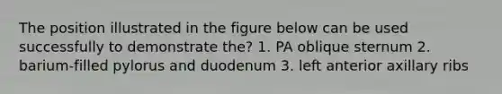 The position illustrated in the figure below can be used successfully to demonstrate the? 1. PA oblique sternum 2. barium-filled pylorus and duodenum 3. left anterior axillary ribs