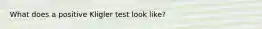 What does a positive Kligler test look like?