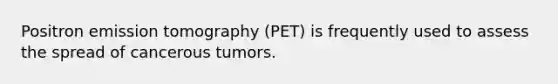 Positron emission tomography (PET) is frequently used to assess the spread of cancerous tumors.