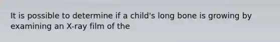 It is possible to determine if a child's long bone is growing by examining an X-ray film of the