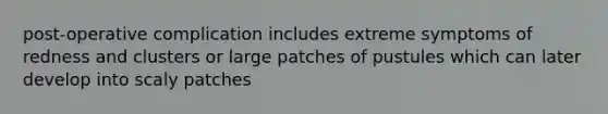 post-operative complication includes extreme symptoms of redness and clusters or large patches of pustules which can later develop into scaly patches