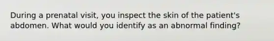 During a prenatal visit, you inspect the skin of the patient's abdomen. What would you identify as an abnormal finding?