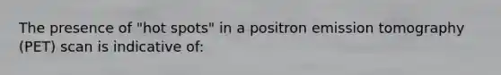 The presence of "hot spots" in a positron emission tomography (PET) scan is indicative of: