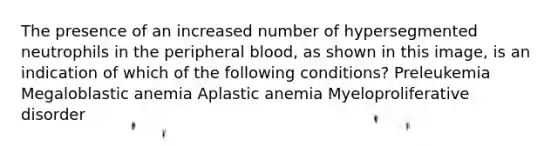 The presence of an increased number of hypersegmented neutrophils in the peripheral blood, as shown in this image, is an indication of which of the following conditions? Preleukemia Megaloblastic anemia Aplastic anemia Myeloproliferative disorder