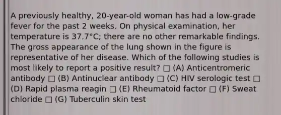 A previously healthy, 20-year-old woman has had a low-grade fever for the past 2 weeks. On physical examination, her temperature is 37.7°C; there are no other remarkable findings. The gross appearance of the lung shown in the figure is representative of her disease. Which of the following studies is most likely to report a positive result? □ (A) Anticentromeric antibody □ (B) Antinuclear antibody □ (C) HIV serologic test □ (D) Rapid plasma reagin □ (E) Rheumatoid factor □ (F) Sweat chloride □ (G) Tuberculin skin test