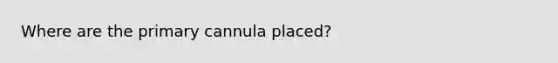 Where are the primary cannula placed?