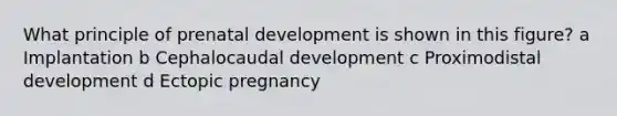 What principle of prenatal development is shown in this figure? a Implantation b Cephalocaudal development c Proximodistal development d Ectopic pregnancy