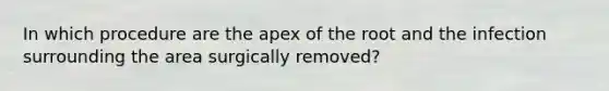 In which procedure are the apex of the root and the infection surrounding the area surgically removed?