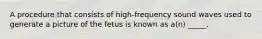 A procedure that consists of high-frequency sound waves used to generate a picture of the fetus is known as a(n) _____.