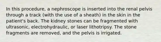 In this procedure, a nephroscope is inserted into the renal pelvis through a track (with the use of a sheath) in the skin in the patient's back. The kidney stones can be fragmented with ultrasonic, electrohydraulic, or laser lithotripsy. The stone fragments are removed, and the pelvis is irrigated.