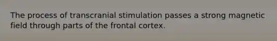 The process of transcranial stimulation passes a strong magnetic field through parts of the frontal cortex.