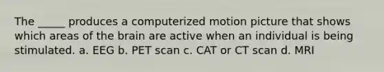 The _____ produces a computerized motion picture that shows which areas of the brain are active when an individual is being stimulated. a. EEG b. PET scan c. CAT or CT scan d. MRI