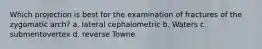 Which projection is best for the examination of fractures of the zygomatic arch? a. lateral cephalometric b. Waters c. submentovertex d. reverse Towne