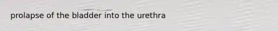 prolapse of the bladder into the urethra