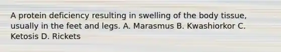 A protein deficiency resulting in swelling of the body tissue, usually in the feet and legs. A. Marasmus B. Kwashiorkor C. Ketosis D. Rickets