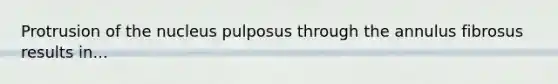 Protrusion of the nucleus pulposus through the annulus fibrosus results in...