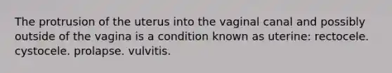 The protrusion of the uterus into the vaginal canal and possibly outside of the vagina is a condition known as uterine: rectocele. cystocele. prolapse. vulvitis.