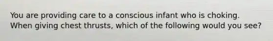 You are providing care to a conscious infant who is choking. When giving chest thrusts, which of the following would you see?