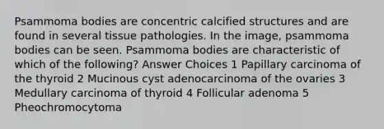 Psammoma bodies are concentric calcified structures and are found in several tissue pathologies. In the image, psammoma bodies can be seen. Psammoma bodies are characteristic of which of the following? Answer Choices 1 Papillary carcinoma of the thyroid 2 Mucinous cyst adenocarcinoma of the ovaries 3 Medullary carcinoma of thyroid 4 Follicular adenoma 5 Pheochromocytoma