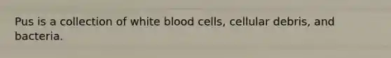 Pus is a collection of white blood cells, cellular debris, and bacteria.