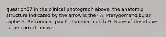 question87 In the clinical photograph above, the anatomic structure indicated by the arrow is the? A. Pterygomandibular raphe B. Retromolar pad C. Hamular notch D. None of the above is the correct answer