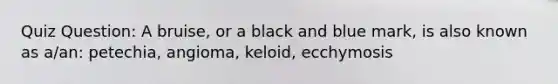 Quiz Question: A bruise, or a black and blue mark, is also known as a/an: petechia, angioma, keloid, ecchymosis