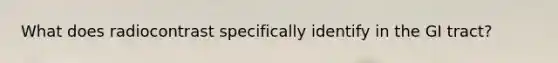 What does radiocontrast specifically identify in the GI tract?