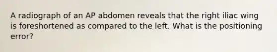 A radiograph of an AP abdomen reveals that the right iliac wing is foreshortened as compared to the left. What is the positioning error?