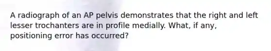 A radiograph of an AP pelvis demonstrates that the right and left lesser trochanters are in profile medially. What, if any, positioning error has occurred?