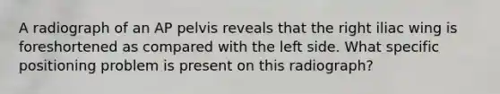 A radiograph of an AP pelvis reveals that the right iliac wing is foreshortened as compared with the left side. What specific positioning problem is present on this radiograph?