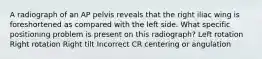 A radiograph of an AP pelvis reveals that the right iliac wing is foreshortened as compared with the left side. What specific positioning problem is present on this radiograph? Left rotation Right rotation Right tilt Incorrect CR centering or angulation