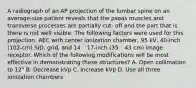 A radiograph of an AP projection of the lumbar spine on an average-size patient reveals that the psoas muscles and transverse processes are partially cut- off and the part that is there is not well visible. The following factors were used for this projection: AEC with center ionization chamber, 95 kV, 40-inch (102-cm) SID, grid, and 14 ´ 17-inch (35 ´ 43 cm) image receptor. Which of the following modifications will be most effective in demonstrating these structures? A. Open collimation to 12" B. Decrease kVp C. Increase kVp D. Use all three ionization chambers