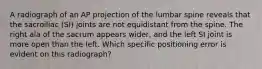 A radiograph of an AP projection of the lumbar spine reveals that the sacroiliac (SI) joints are not equidistant from the spine. The right ala of the sacrum appears wider, and the left SI joint is more open than the left. Which specific positioning error is evident on this radiograph?